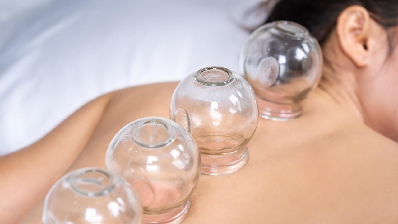 Cupping therapy is a Traditional Chinese Medicine (TCM) practice that has been used for centuries to improve blood circulation, relieve muscle tension, reduce pain, and promote overall well-being.
