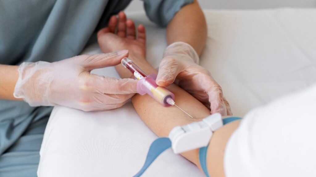 Different Ways to Test Cortisol Levels