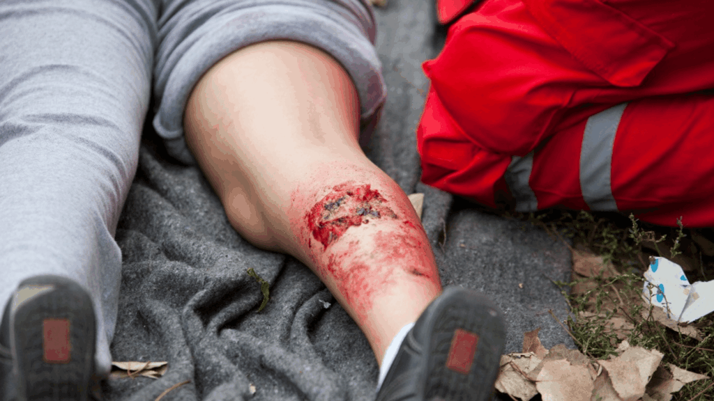 Common injuries and accidents in Malaysia, highlighting the need for better safety practices.
