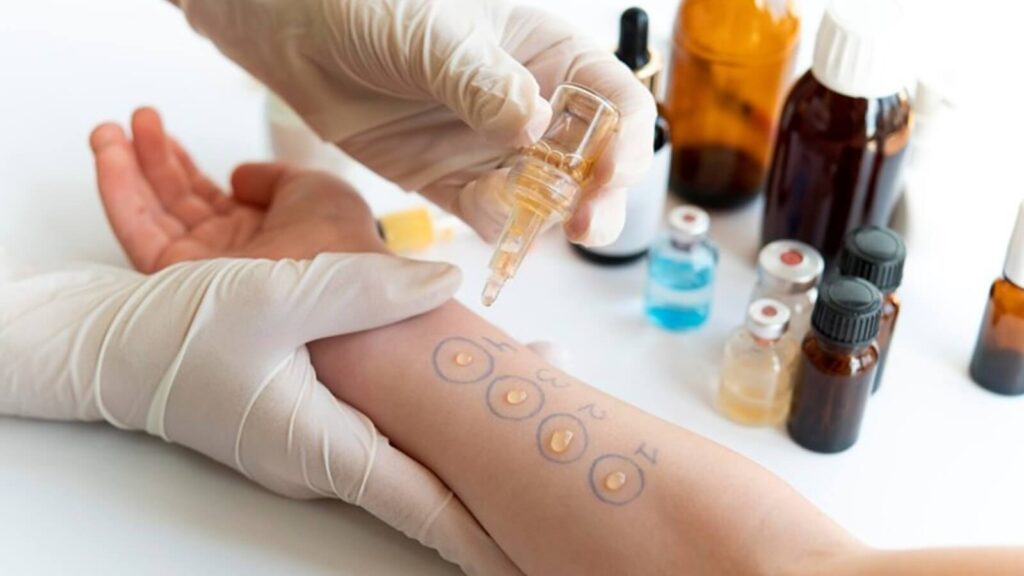 Accurate diagnosis is the first step toward effective allergy management.