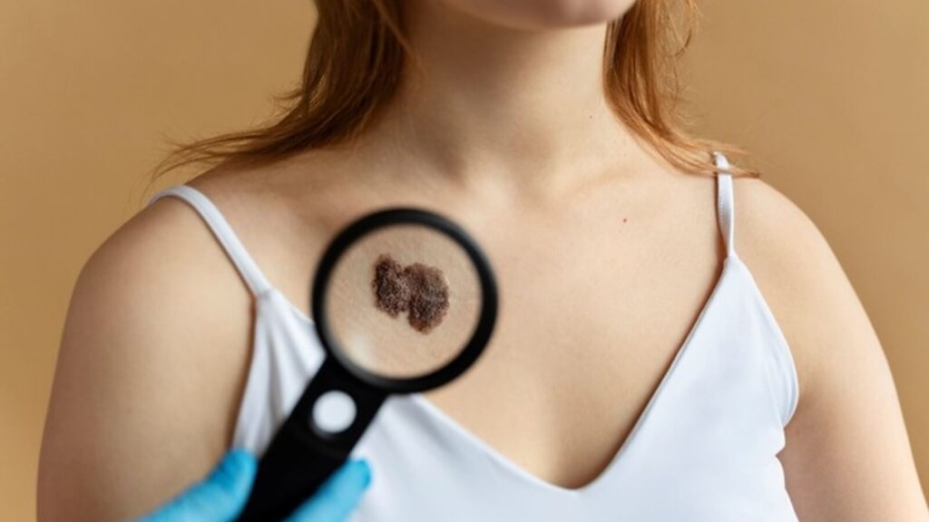 Understand what skin cancer is, its types, and how to identify warning signs.